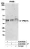 VPS37A Subunit Of ESCRT-I antibody, A304-963A, Bethyl Labs, Immunoprecipitation image 