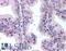 PBIP1 antibody, LS-B211, Lifespan Biosciences, Immunohistochemistry paraffin image 