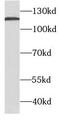 SDC antibody, FNab01424, FineTest, Western Blot image 