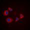 cAMP-dependent protein kinase type I-alpha regulatory subunit antibody, orb376093, Biorbyt, Immunofluorescence image 