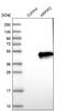 ADP Ribosylation Factor Interacting Protein 2 antibody, NBP1-87255, Novus Biologicals, Western Blot image 