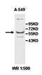 Zinc Finger Protein 20 antibody, orb78008, Biorbyt, Western Blot image 