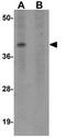 Melanocortin 4 Receptor antibody, GTX31382, GeneTex, Western Blot image 