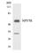 Neuropeptide Y Receptor Y5 antibody, LS-C200281, Lifespan Biosciences, Western Blot image 