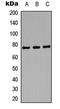 Amphiphysin antibody, LS-C354531, Lifespan Biosciences, Western Blot image 