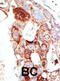 Sentrin-specific protease 6 antibody, abx026785, Abbexa, Immunohistochemistry paraffin image 