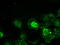 TYRO3 Protein Tyrosine Kinase antibody, LS-C114525, Lifespan Biosciences, Immunofluorescence image 