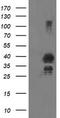 Ubiquitin Conjugating Enzyme E2 J1 antibody, TA504973AM, Origene, Western Blot image 