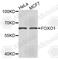 Forkhead Box O1 antibody, A0885, ABclonal Technology, Western Blot image 