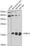 Fatty Acid Binding Protein 12 antibody, 23-963, ProSci, Western Blot image 