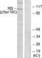 RB Transcriptional Corepressor 1 antibody, LS-C117467, Lifespan Biosciences, Western Blot image 