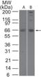 Sentrin-specific protease 2 antibody, NB100-56406, Novus Biologicals, Western Blot image 