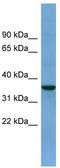 Beta-secretase 2 antibody, TA341894, Origene, Western Blot image 