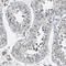 Transglutaminase 2 antibody, HPA021019, Atlas Antibodies, Immunohistochemistry paraffin image 