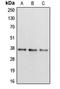 Apolipoprotein L2 antibody, LS-C353364, Lifespan Biosciences, Western Blot image 