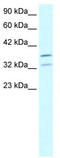 Forkhead Box L1 antibody, TA330240, Origene, Western Blot image 