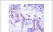 Progesterone Receptor antibody, OAEC00073, Aviva Systems Biology, Immunohistochemistry frozen image 