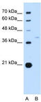 Replication factor C subunit 3 antibody, TA339257, Origene, Western Blot image 