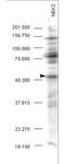 NIMA Related Kinase 2 antibody, A01606, Boster Biological Technology, Western Blot image 