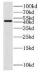 Fucosyltransferase 10 antibody, FNab03245, FineTest, Western Blot image 