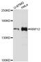 Ribosomal RNA Processing 12 Homolog antibody, A09838, Boster Biological Technology, Western Blot image 