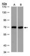 Plastin 3 antibody, PA5-27883, Invitrogen Antibodies, Western Blot image 