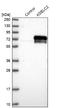 Protein O-Glucosyltransferase 3 antibody, NBP1-92047, Novus Biologicals, Western Blot image 