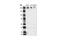 Platelet Derived Growth Factor Receptor Beta antibody, 3162S, Cell Signaling Technology, Western Blot image 