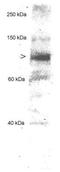 MLX Interacting Protein Like antibody, GTX30677, GeneTex, Western Blot image 