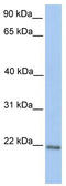 Zinc Finger Protein 548 antibody, TA345570, Origene, Western Blot image 