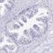 Tissue Factor Pathway Inhibitor 2 antibody, PA5-61900, Invitrogen Antibodies, Immunohistochemistry frozen image 