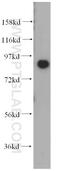 Amine Oxidase Copper Containing 3 antibody, 14365-1-AP, Proteintech Group, Western Blot image 