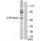 Cytochrome P450 Family 3 Subfamily A Member 43 antibody, A06947, Boster Biological Technology, Western Blot image 