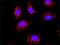 Hspa1 antibody, H00003304-M05, Novus Biologicals, Proximity Ligation Assay image 