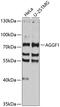 Angiogenic factor with G patch and FHA domains 1 antibody, 23-471, ProSci, Western Blot image 