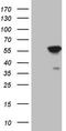 4-Aminobutyrate Aminotransferase antibody, LS-C340143, Lifespan Biosciences, Western Blot image 