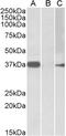 Proteasome Subunit Beta 7 antibody, 42-649, ProSci, Western Blot image 