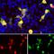 mCherry Tag  antibody, NBP2-25158, Novus Biologicals, Immunocytochemistry image 