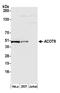 Acyl-CoA Thioesterase 9 antibody, A305-796A-M, Bethyl Labs, Western Blot image 