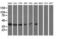 Sterol O-Acyltransferase 2 antibody, LS-C115245, Lifespan Biosciences, Western Blot image 