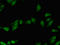 DNA Polymerase Lambda antibody, LS-C679091, Lifespan Biosciences, Immunofluorescence image 