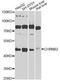 Cholinergic Receptor Nicotinic Beta 2 Subunit antibody, A9808, ABclonal Technology, Western Blot image 