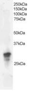 Myotubularin-related protein 9 antibody, orb18344, Biorbyt, Western Blot image 