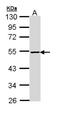 Phosphatidylinositol-5-phosphate 4-kinase type-2 beta antibody, NBP2-19837, Novus Biologicals, Western Blot image 