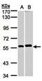 Serine/threonine-protein phosphatase 2B catalytic subunit beta isoform antibody, orb73681, Biorbyt, Western Blot image 