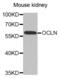 Occludin antibody, abx005226, Abbexa, Western Blot image 