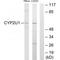 Cytochrome P450 Family 2 Subfamily U Member 1 antibody, A08272, Boster Biological Technology, Western Blot image 