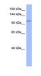 Adenosine Deaminase RNA Specific B2 (Inactive) antibody, orb330174, Biorbyt, Western Blot image 