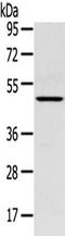 Serpin Family B Member 11 (Gene/Pseudogene) antibody, TA350409, Origene, Western Blot image 