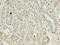Kelch Like ECH Associated Protein 1 antibody, A50322-100, Epigentek, Immunohistochemistry paraffin image 